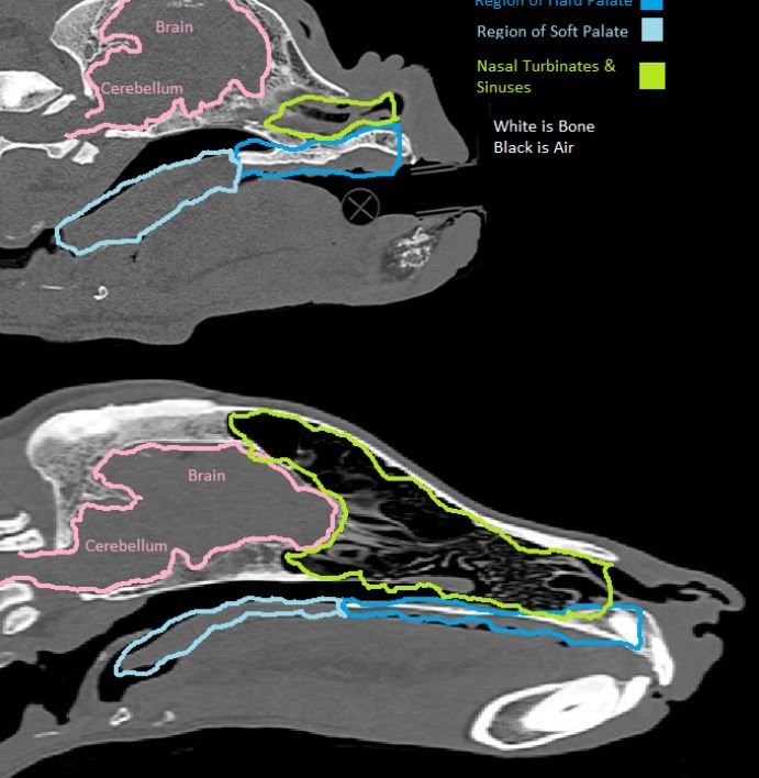 Annotated CT scan of nasal tumour